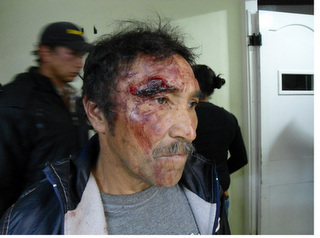 Campesino en defensa del Páramo de Pisba  agredido por la policía a favor de la multinacional CLEAN POWER